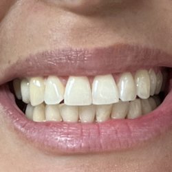 VIP Dental Spa