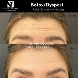 Virginia Square Dermatology