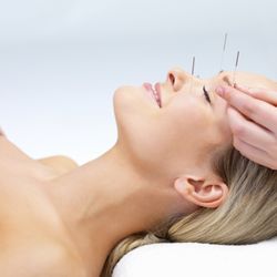 Myung K Kim Acupuncture
