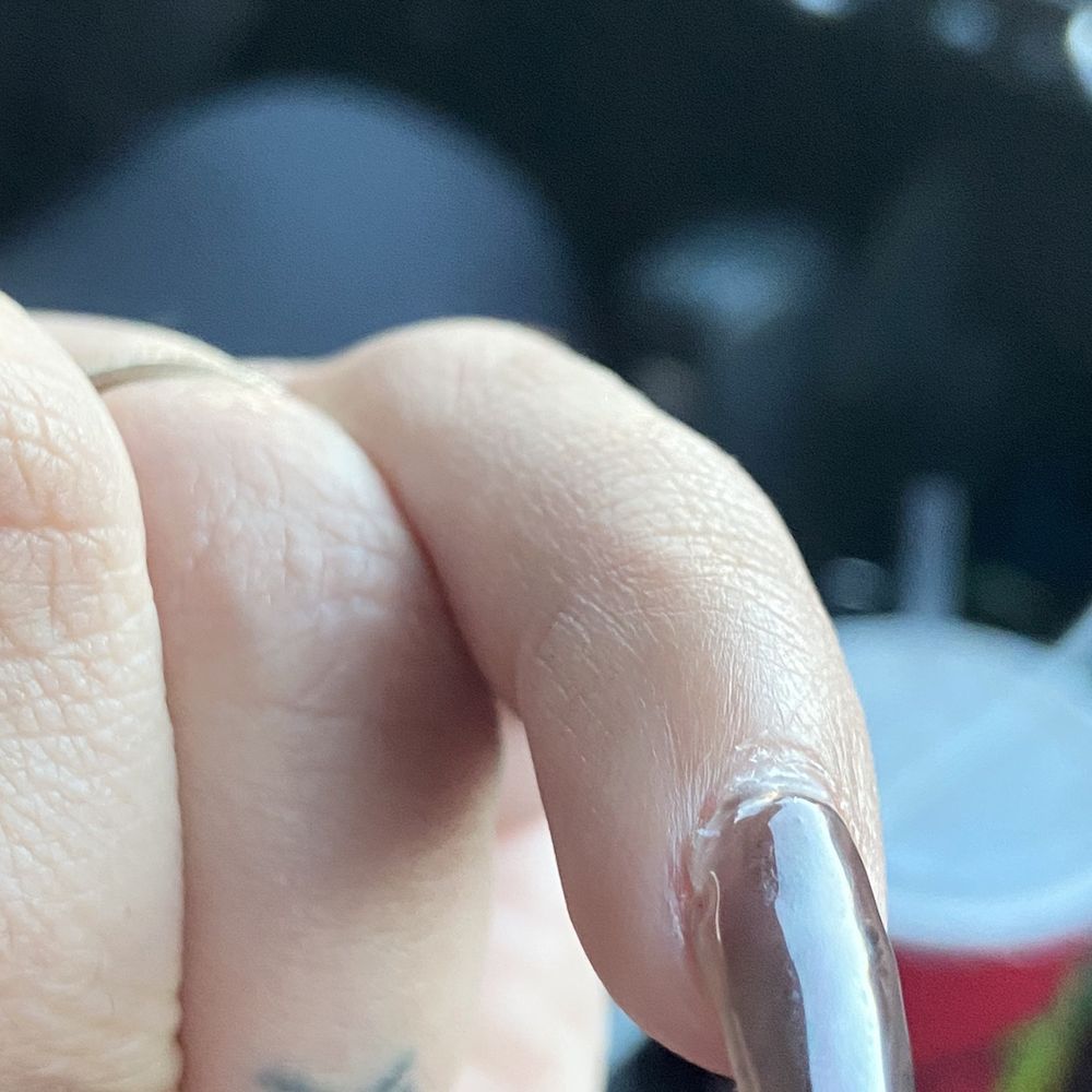 (Already fallen off) there was a chunk of acrylic on cuticle on left