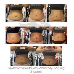 Mintbody Med Spa