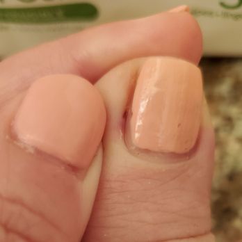Pretty Nail Lounge - Toe cut from pedicure - Nail Salons Near Me - Montebello, California
