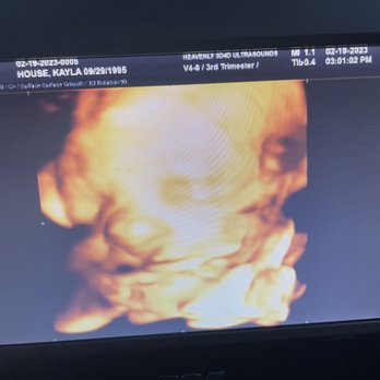 Heavenly 3D4D Ultrasound - Diagnostic Imaging Near Me - Riverside, California Heavenly 3D4D Ultrasound - Diagnostic Imaging Near Me - Riverside, California