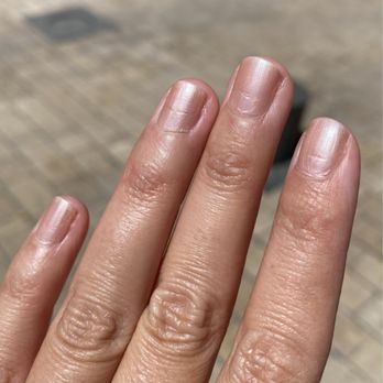 Artistic Nails - Nail scars from the drill the Artistic Nails manicurist used to eliminate my cuticles 5 weeks ago - Nail Salons Near Me - Lincoln, California