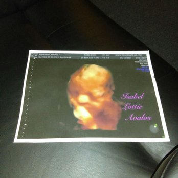Procreate 4d - Our canvas print - Diagnostic Imaging Near Me - Los Angeles, California
