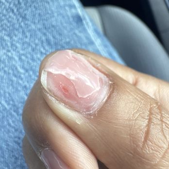Lily's Nail Spa - my thumb is so sensitive i can't even take the gel off - Nail Salons Near Me - Goleta, California