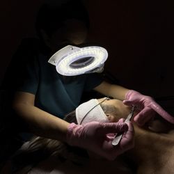 Excell MedSpa - Dermaplane facial