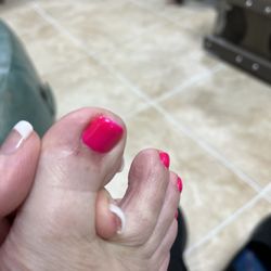 Nails of America Loop 336 - Bruised toe