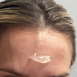 La Beaute Medical Aesthetics - My whole face did this the day of the event