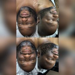 Men's hydrating facial