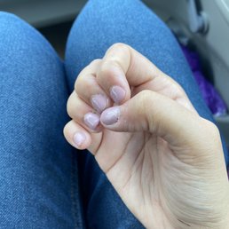 Horrible nail job, painted over my cuticle