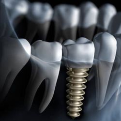 1st Scottsdale Dental