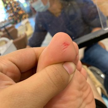 L A Nails - Peeled skin!! - Nail Salons Near Me - Lake Elsinore, California L A Nails - Peeled skin!! - Nail Salons Near Me - Lake Elsinore, California