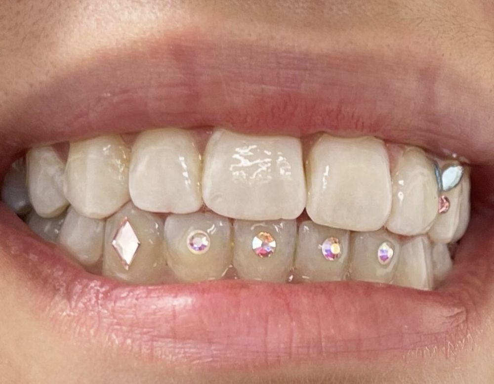 NEW SHYNE WHITENING & GEM SERVICE Updated July 2024 Request an