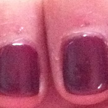 Empress Nails II Day Spa - Cuticles 2 days after the manicure. - Nail Salons Near Me - Lisle, Illinois
