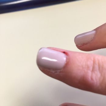 Romantic Nail Salon - Cut cuticle. - Nail Salons Near Me - Ventura, California Romantic Nail Salon - Cut cuticle. - Nail Salons Near Me - Ventura, California