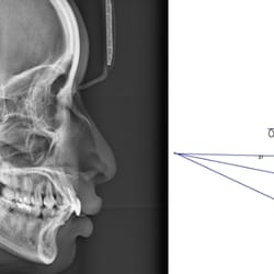 McKee Dental X-Ray