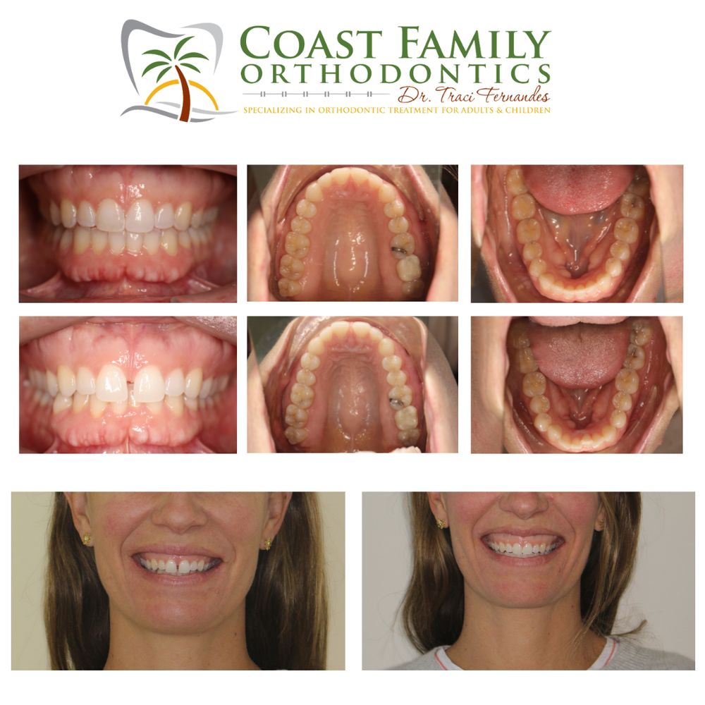 TRACI R FERNANDES, DDS COAST FAMILY ORTHODONTICS Updated September