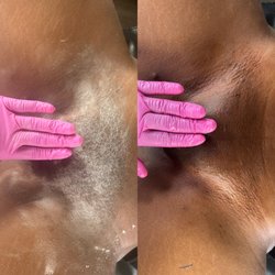 Brittany Nicolee Esthetics Lounge - Before and After Full Brazilian