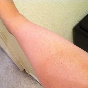 Ella Blue - STREAKY spray tan - Day Spas Near Me - Elk Grove, California Ella Blue - STREAKY spray tan - Day Spas Near Me - Elk Grove, California