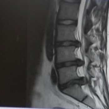 Martin Quirno, MD - my spine - Orthopedists Near Me - New York, New York Martin Quirno, MD - my spine - Orthopedists Near Me - New York, New York
