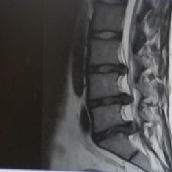 My spine