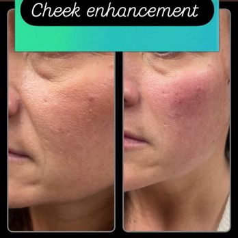 Omorfo Derma - Medical Spas Near Me - Chardon, Ohio