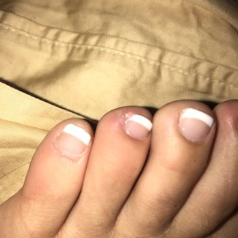 Pretty Nails - Hang nail on my toe - Nail Salons Near Me - Escondido, California Pretty Nails - Hang nail on my toe - Nail Salons Near Me - Escondido, California