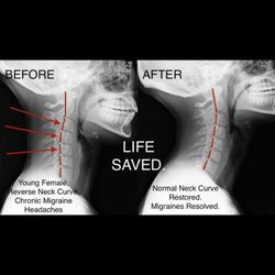 Structural Chiropractic
