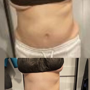 Glam Sculpting - Masajes reductores y reduce la inflamación - Body Contouring Near Me Glam Sculpting - Masajes reductores y reduce la inflamación - Body Contouring Near Me
