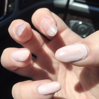 Allure Nail Bar - Uneven, bumpy, and turning brown or peeling off. - Nail Salons Near Me - Duluth, Georgia