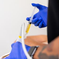 XLB Physical Medicine - Guided PRP Injection for Hip Pain