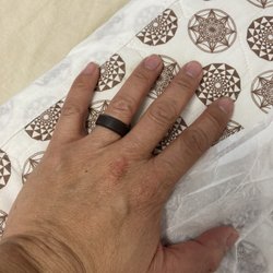 Yin Yang Acupuncture - I love the heated pad