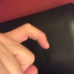The Hand Center of Southern California
