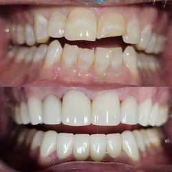 Amazing Dental - Smile makeover