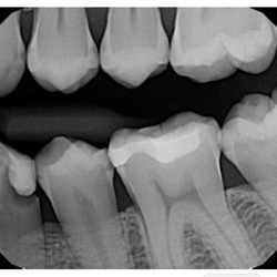 Dove Dental Services