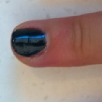 Waynita Nails - Cellulitis - Nail Salons Near Me - Kirkland, Washington Waynita Nails - Cellulitis - Nail Salons Near Me - Kirkland, Washington