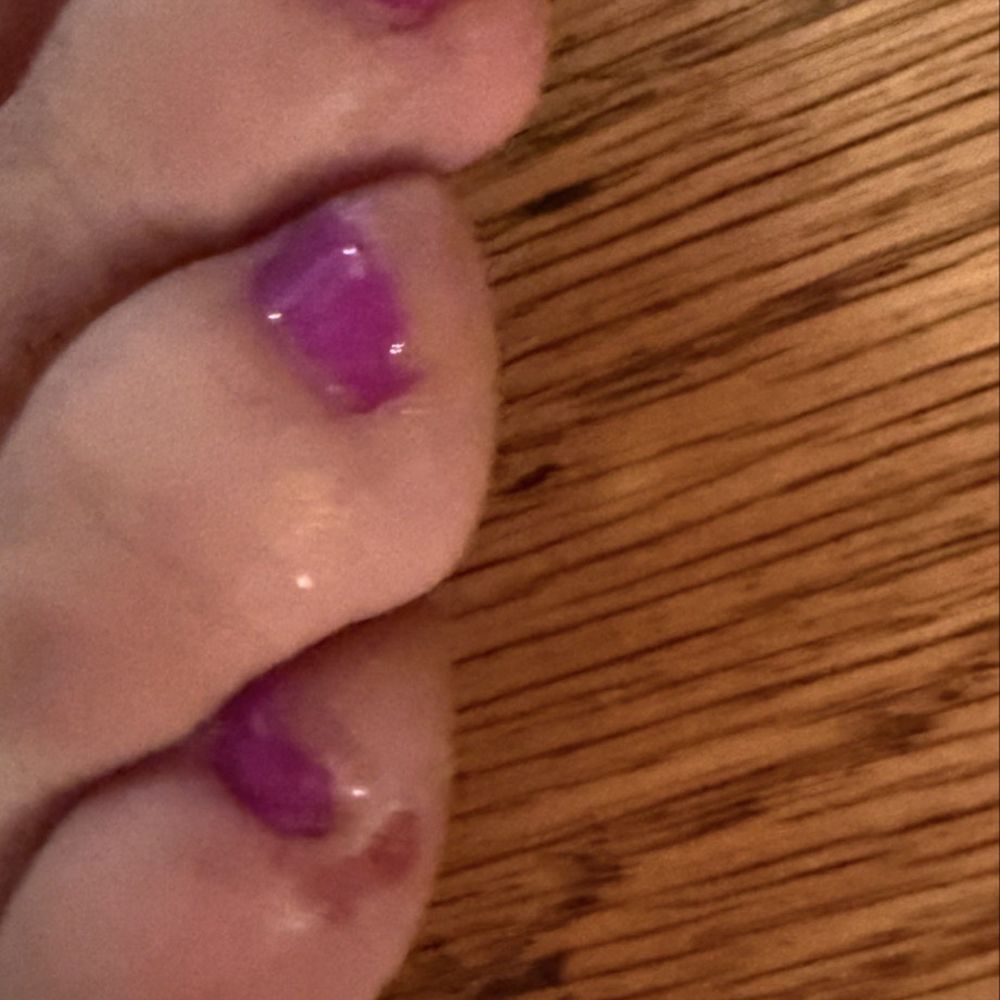 My toes with two cuts. My toes with two cuts.