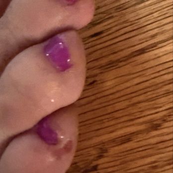 Lisa's Nail & Spa - My toes with two cuts. - Nail Salons Near Me - Fresno, California Lisa's Nail & Spa - My toes with two cuts. - Nail Salons Near Me - Fresno, California