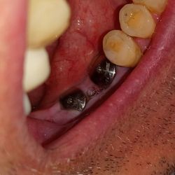 Pacific Dental Centre - Bought my smile back somewhere else.