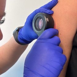Better Skin Dermatology - Maricopa - Dermatascopes help get a closer, more in-depth look at your skin!
