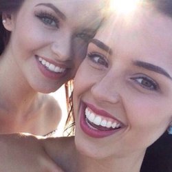 Smile Dentistry - ZOOM WHITENING For the brightest white teeth
