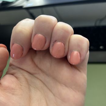 Infinity Nails - On the ring finger you can see where she drilled off my skin around my cuticle. - Nail Salons Near Me - Tucson, Arizona