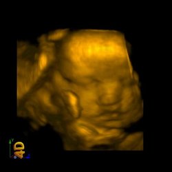 My Beautiful Granddaughter.