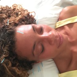 Christine Walinch, LAc - Facial Acupuncture    (808) 353-1221For Appt.  North Shore Kauai Outcalls/ Home Visits Available