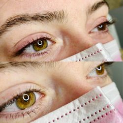Eyelash Enhancement