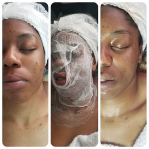 LA Body Contouring on Yelp