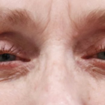 Pacific Eye Associates - This picture was taken today, March 5, 2022 - Ophthalmologists Near Me - San Francisco, California Pacific Eye Associates - This picture was taken today, March 5, 2022 - Ophthalmologists Near Me - San Francisco, California