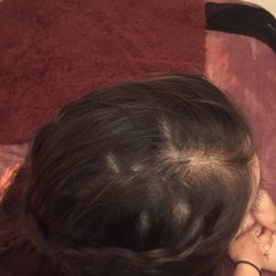Art & Beauty Salon - Bold spots on my daughters head after Harold finish styling her hair