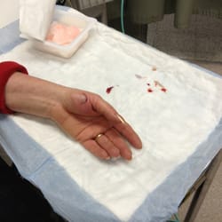 Quincy Valley Medical Center - So much for a knife set for Christmas!
